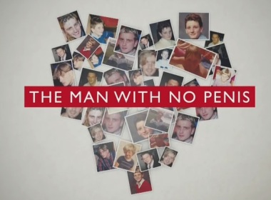 Man With No Penis 8