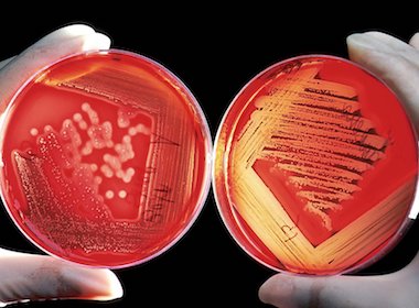 taken-over-by-aliens-our-bodies-host-1-3-microbes-per-living-cell-4 Taken over by aliens: Our bodies host 1.3 microbes per living cell